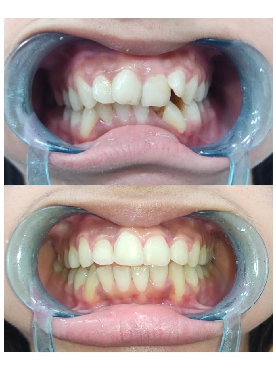 Advanced dental equipment